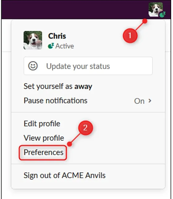 Slack Dm'den Profil Fotoğrafları Nasıl Kaldırılır?