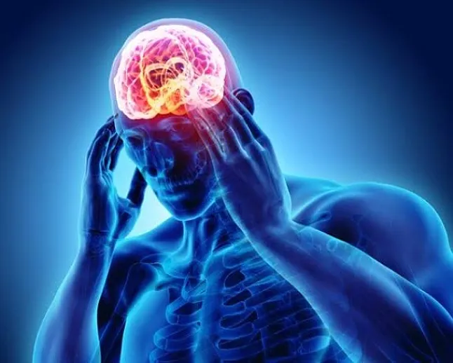 Migren Nedir ?