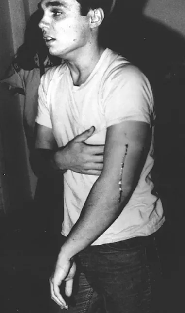 Chris Burden Kimdir ? Hayatı Ve Biyografisi